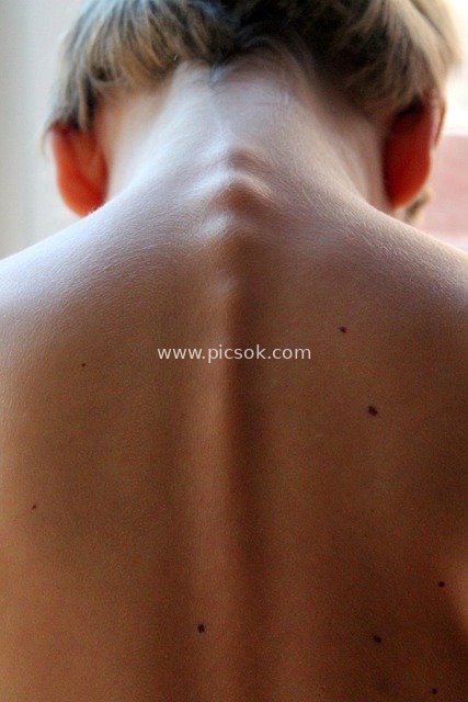 Close-up of a Child's Back and Spine - Detailed Skin and Hair Texture Material Image