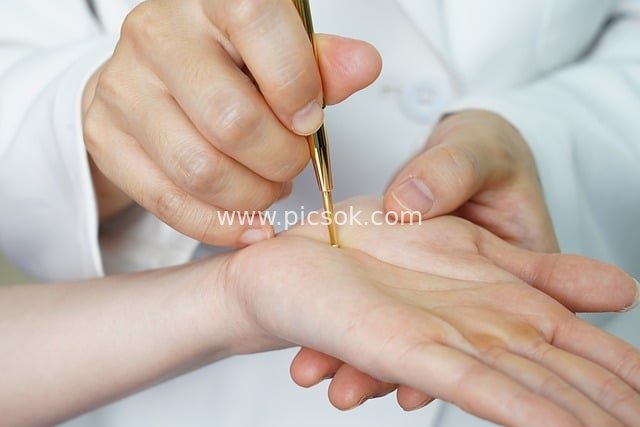Traditional Chinese Medicine Hand Acupuncture Diagnosis and Treatment - Acupoint Stimulation Health Care Scene
